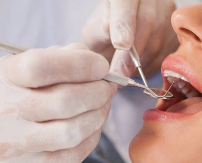 Come il bruxismo influisce sui tuoi denti – e come trattarlo