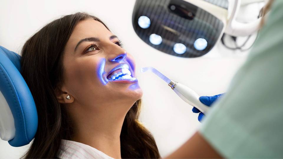Le più recenti tecniche di sbiancamento dentale: Cosa c’è da sapere