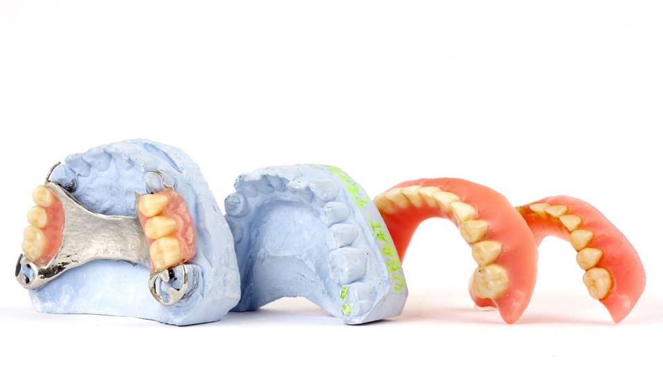 Le diverse tipologie di protesi dentarie e come scegliere quella più adatta a te