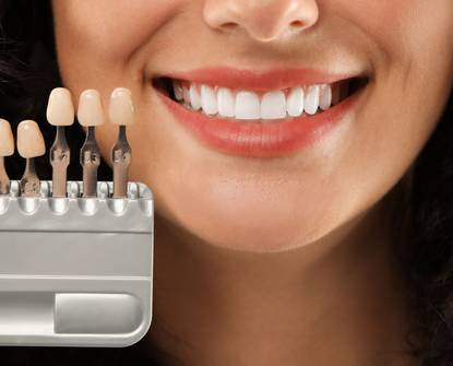 Come le faccette dentali possono trasformare il tuo sorriso