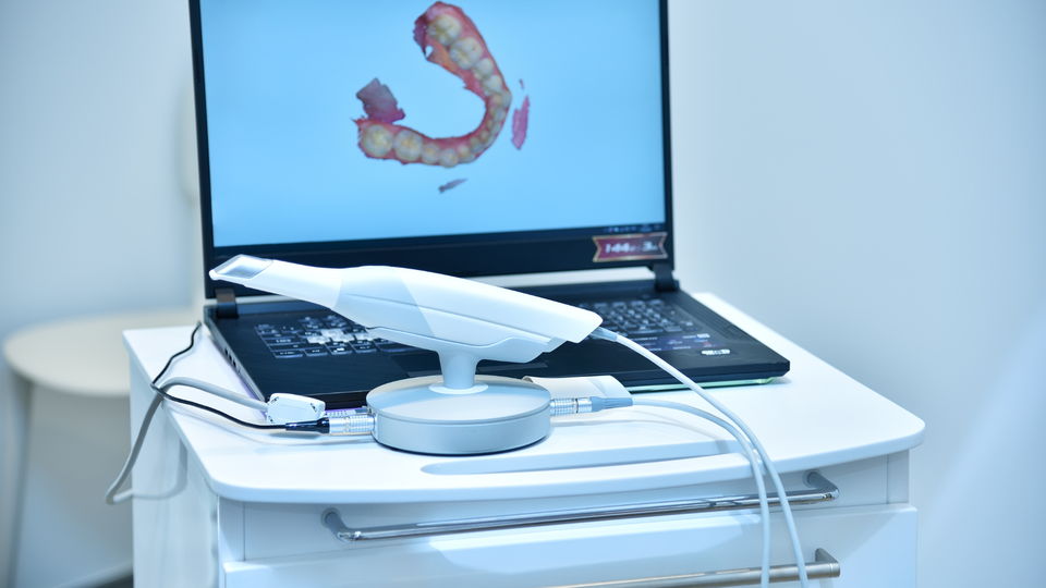 Impronte digitali in odontoiatria: più veloci, precise e senza disagio