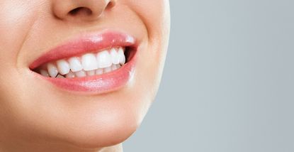 Estetica dentale: Come migliorare l’aspetto del tuo sorriso