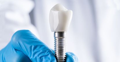 Mini impianti: quando sono una buona soluzione e a chi sono destinati?