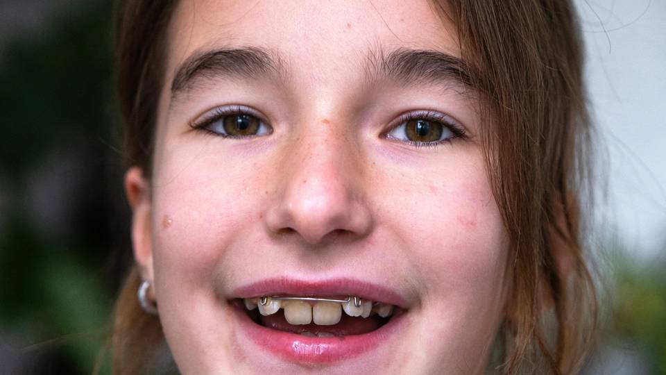 Opzioni ortodontiche per bambini e adolescenti: quando è il momento giusto per l’apparecchio?