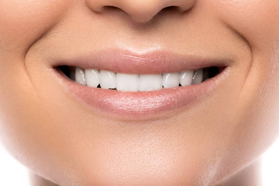 Rinfresca il tuo sorriso: I migliori consigli per la cura dentale durante i mesi estivi