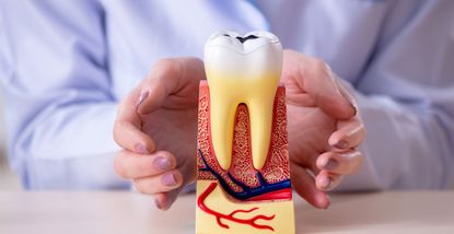 Cosa fare in caso di infiammazione del nervo dentale: Trattamenti e prevenzione