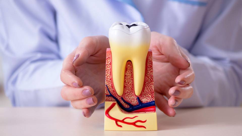 Cosa fare in caso di infiammazione del nervo dentale: Trattamenti e prevenzione