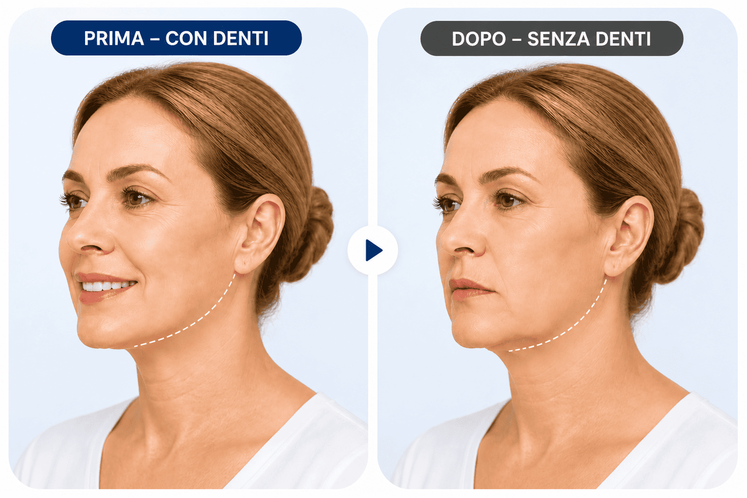 prima e dopo con e senza denti 